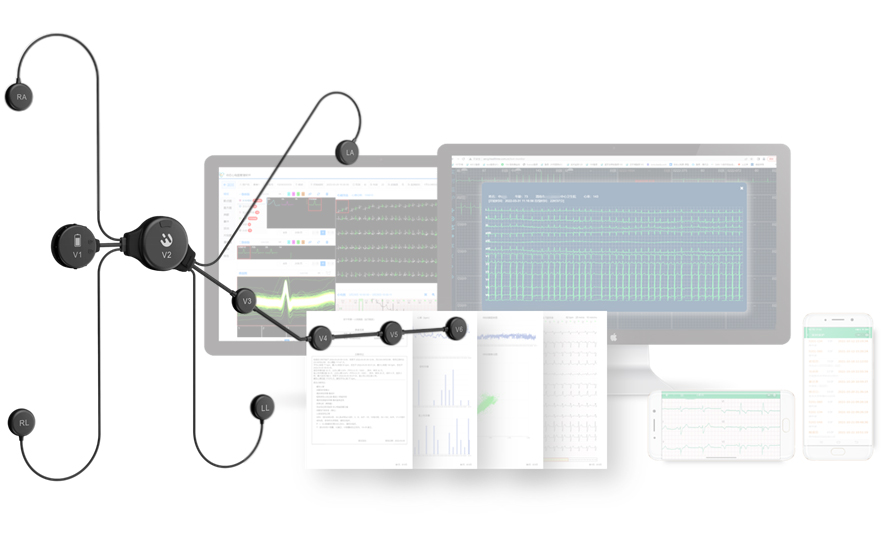 穿戴式心电记录仪的独特价值