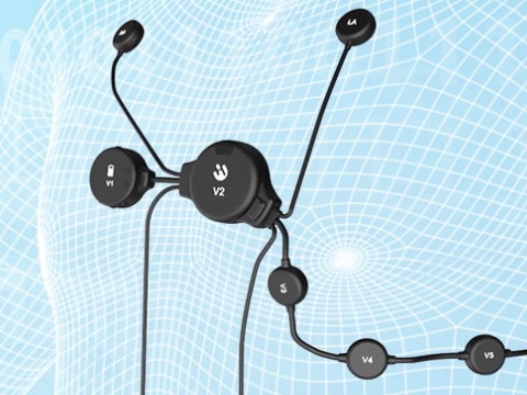 心脏康复为何需要用到心电记录仪？