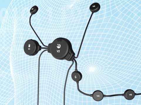 选择单导心贴要注意什么？电极数量和位置