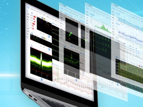 什么是心脏远程监测，有怎么样的发展前景？